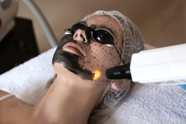 HydraFacial With Carbon Peel