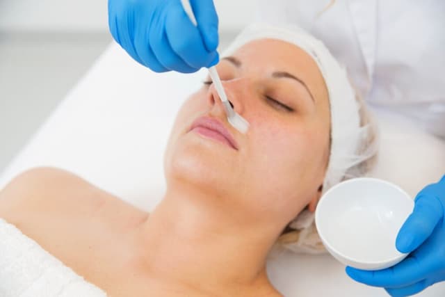 Chemical Peel