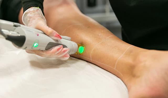 Laser Sessions