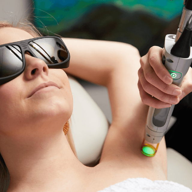Laser Sessions